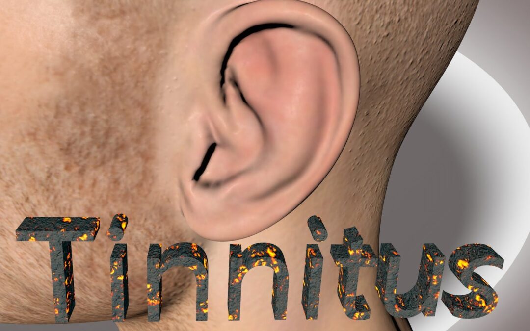 tinnitus anxiety